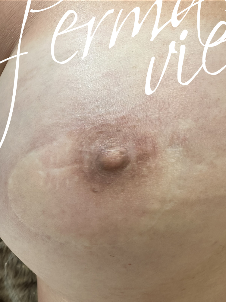 750x1000-areole-mammaire_5b
